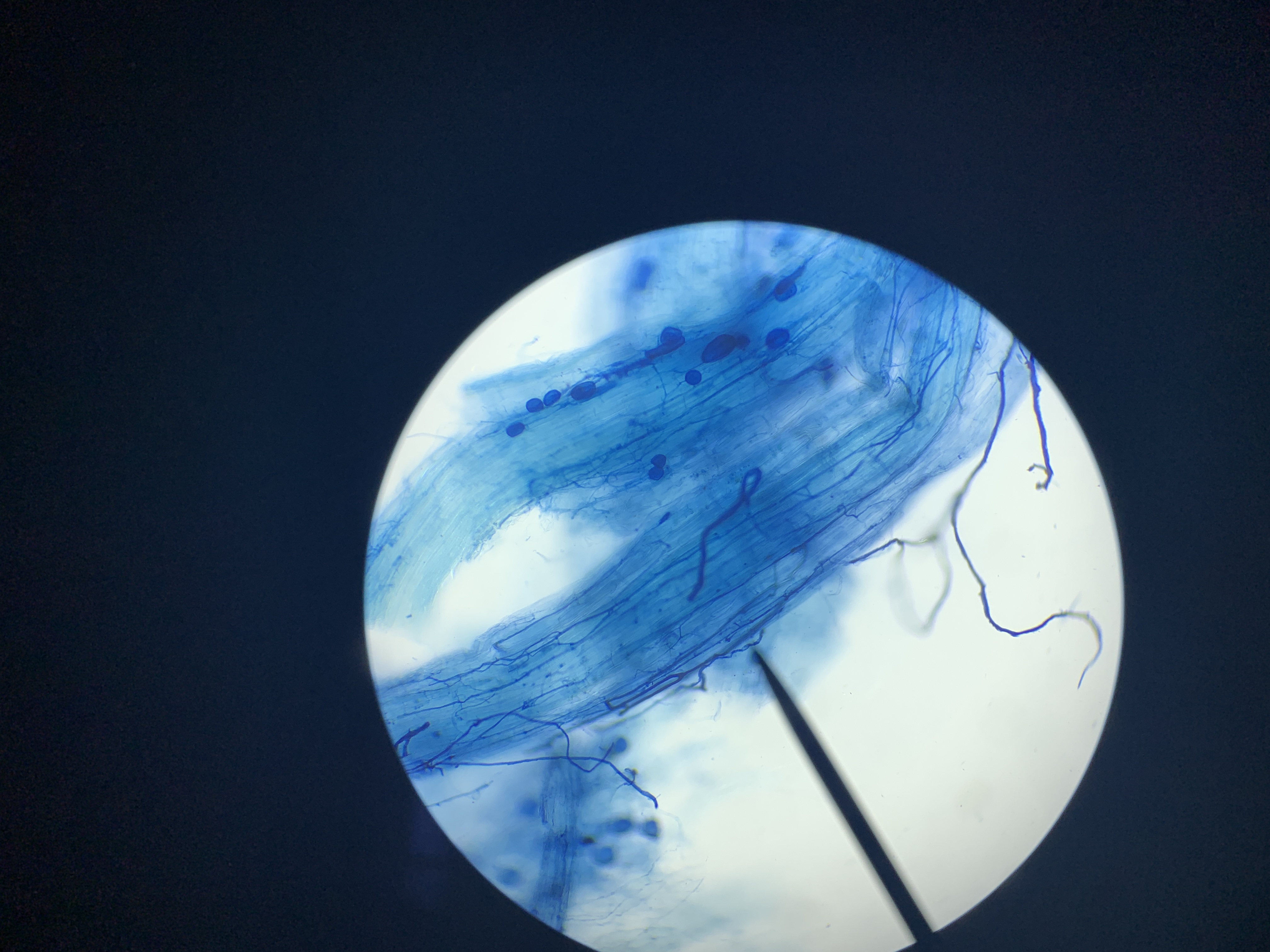 blue microscopic image of mycorrhizal fungi 